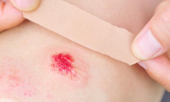 创可贴的另类日常妙用 六种情况下严禁使用创可贴-八凡集