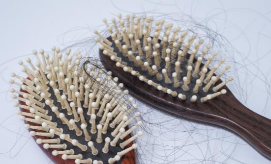 OMG!产后脱发这么严重吗?