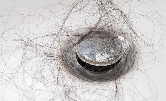 OMG!产后脱发这么严重吗?