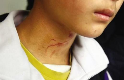 20个生活中的急救常识日常生活中,意外伤害很难避免,有时