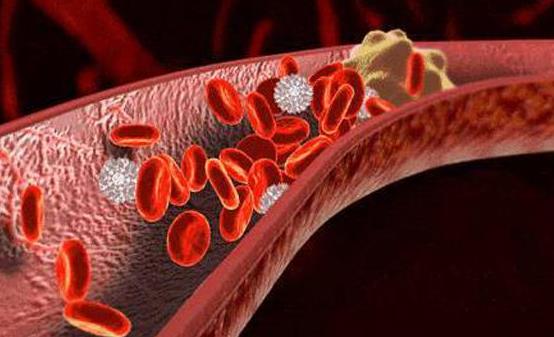 能软化血管的12种食物 让血管恢复正常-八凡集