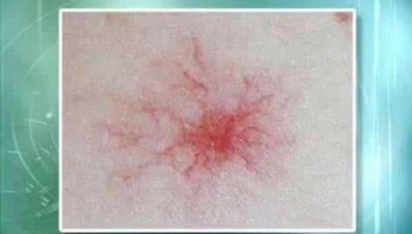 长期睡前玩手机的人,面部若有3症状,可能是肝在“吐槽”