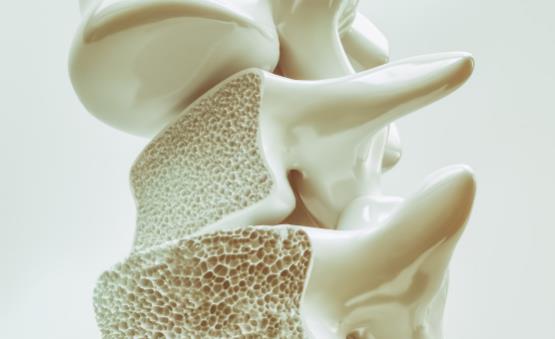 骨质疏松的认知误区你中了没 骨质疏松的饮食保健-八凡集