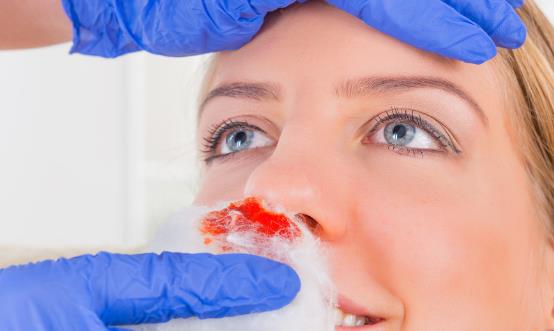 好用的止鼻血的方法 食物也能治疗流鼻血-八凡集