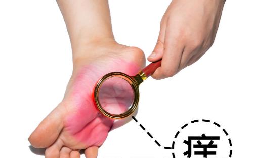 有脚气的人,经常用盐水泡脚就能消灭真菌吗?它没有这个