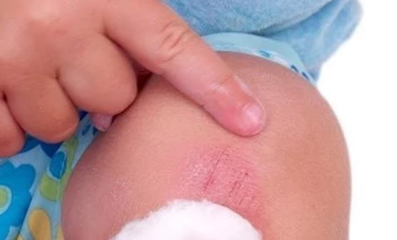 一不留神宝宝受伤了 父母镇定处理好方法推荐-八凡集