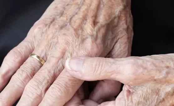 老年斑并不是老年人的专利 预防和延缓老年斑发生的食物-八凡集