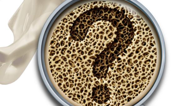 骨质疏松的常见认知误区 看看你有没有中招-八凡集