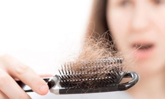 导致女性掉发的6个原因 做好防辐射工作预防掉发-八凡集