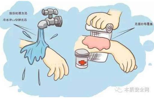 阻止继续烧伤只要18秒-八凡集