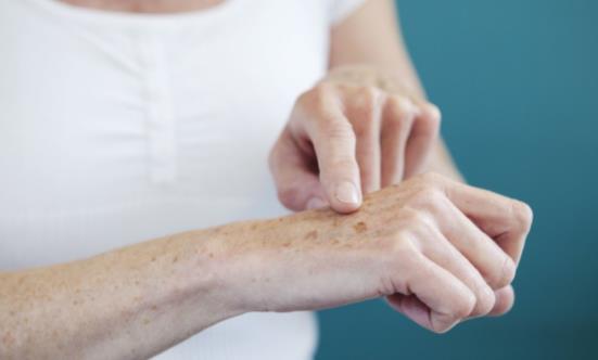 老人手上长老年斑怎么办 缓解老年斑的食疗法-八凡集