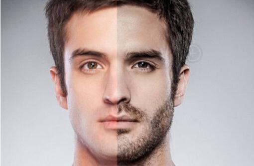 娃娃脸男人选择胡须移植-八凡集