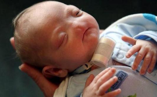 没有鼻子的婴儿,妈妈说他是完美的-八凡集