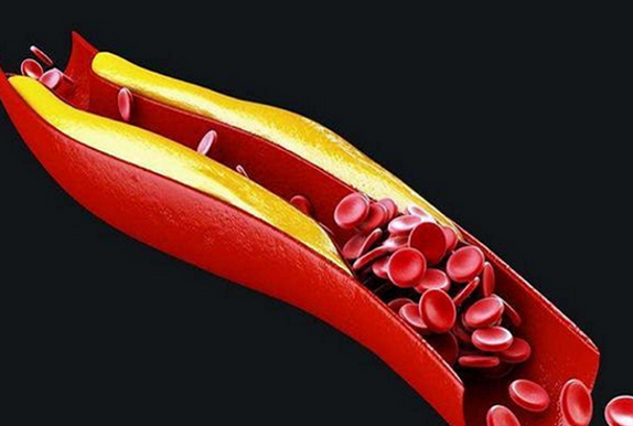 10种人不宜喝酸奶-八凡集