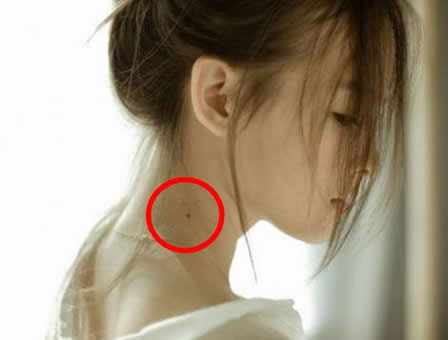 女人脖子右侧有痣图解-八凡集